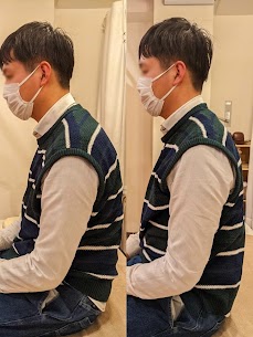 長堀橋の整骨院では鍼治療で猫背が改善し姿勢もスッキリ